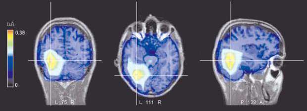 Imagens de ressonância magnética feitas durante estudo sobre o cérebro na Universidade de Milão, na Itália: a técnica permite a análise detalhada do organismo de forma não invasiva (Alice Mado Proverbio)