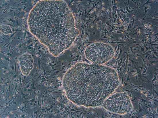 Células-tronco embrionárias humanas que deram origem a células precursoras de óvulos e espermatozoides  (Renee Reijo Pera/Universidade de Stanford)