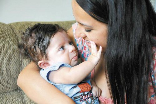 Diagnosticado com a doença depois do nascimento, Miguel Caldeira, 6 meses, recebe carinho da mãe, Taís (Beto Novaes/EM/D.A Press)