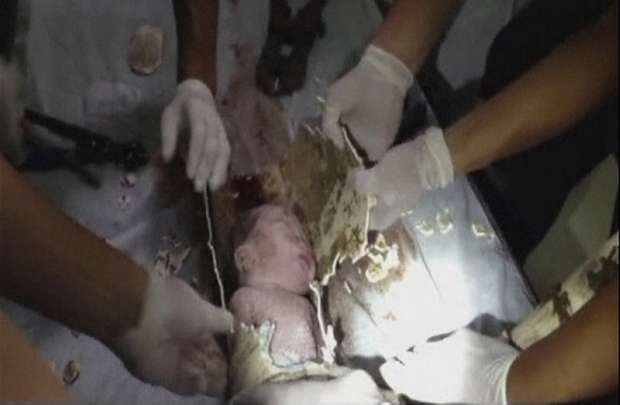 Bombeiros e médicos resgatam bebé recém-nascido abandonado encontrado em cano na cidade de Jinhua, província de Zhejiang, na China (China Central Television/Reuters)