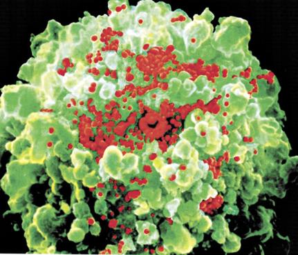 Os linfócitos (verde) são alvo do HIV (vermelho). Com a vacina, essas células de defesa ficariam protegidas  (NIADI/Divulgação )