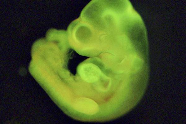 Imagem mostra embrião de camundongo que teria se desenvolvido com a ajuda das novas células-tronco 
 (Haruko Obokata/Reuters)