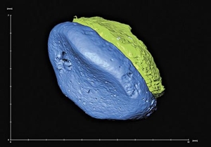 Pela primeira vez, cientistas conseguem fazer a análise genética completa de um grupo humano extinto os denisovanos, que viveram entre 50 mil e 80 mil anos atrás. O estudo ajudará a entender melhor como ocorreu a evolução do homem moderno