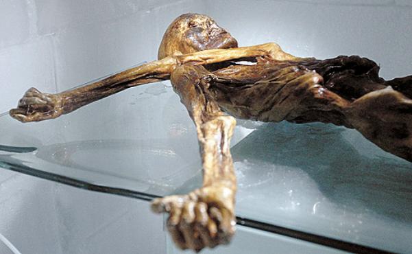 Ötzi, caçador que viveu há 5 mil anos e teve o corpo preservado pelo gelo: a pesquisa revelou entupimento nas carótidas, que levam sangue do coração para o cérebro