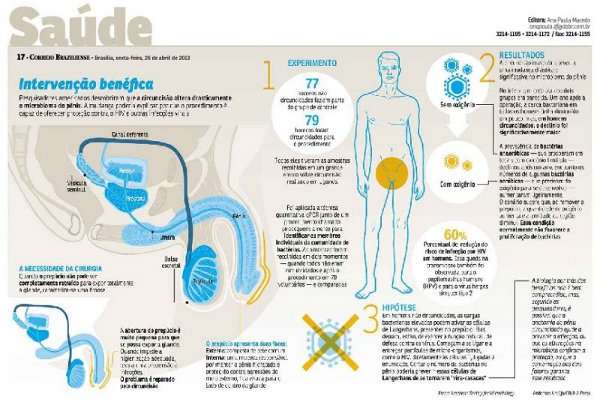 Cientistas descobrem que a retirada do prepúcio leva a uma queda considerável da quantidade de bactérias no pênis, reduzindo a incidência de doenças sexualmente transmissíveis