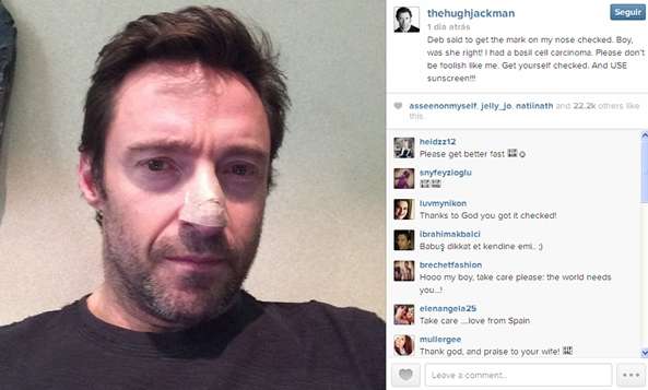 O intérprete de Wolverine revelou em sua conta no Instagram que passa por tratamento para retirar um tumor na pele