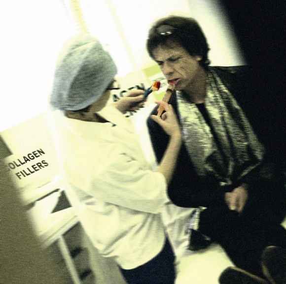 Sósia do Mick Jagger aplicando botox