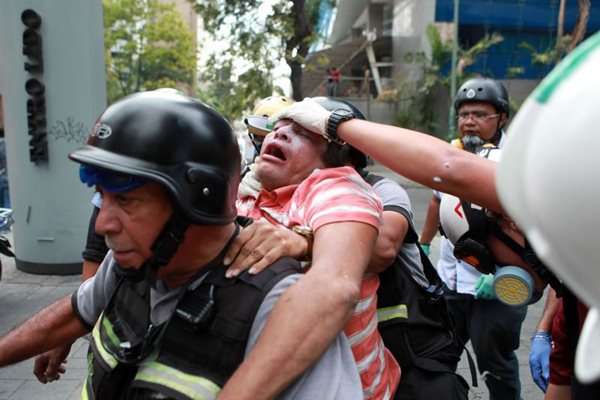 Bombeiro ajudar um manifestante contra o governo durante um protesto em Caracas, Venezuela. Número de mortos em protestos chega a 39