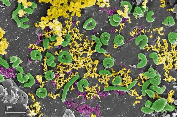 Seres microscópicos quebram a estrutura do cobre ao se alimentar de elementos aos quais o metal está associado