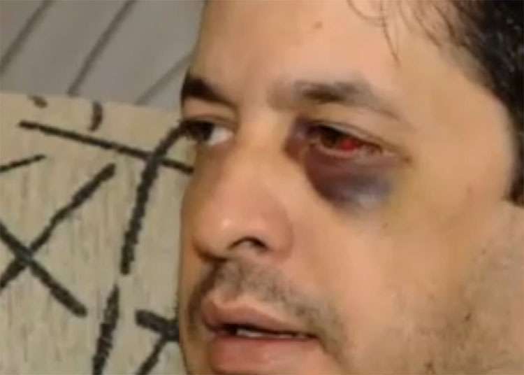 Homem é agredido com socos em estacionamento de shopping de Brasília