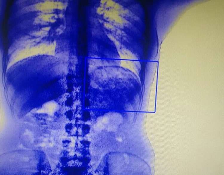 Droga detectada pelo scanner
