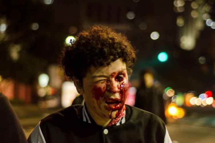 Jovem atingida por bala de borracha no rosto durante Protesto contra o presidente do Brasil, Michel Temer em São Paulo (SP)