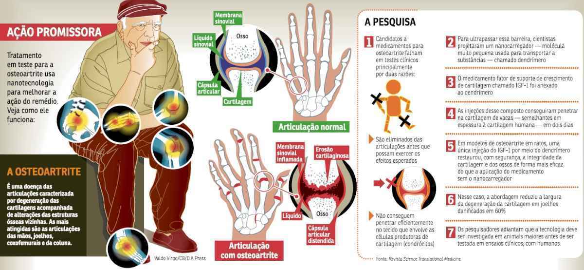 osteoartrite