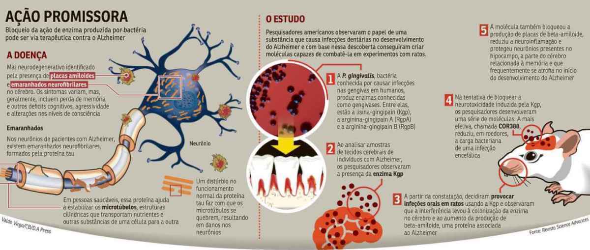 Responsável pela periodontite, micro-organismo libera enzima que se concentra no cérebro de pacientes com a doença neurodegenerativa. Em testes com ratos, o combate à substância tóxica também reduz danos neurais