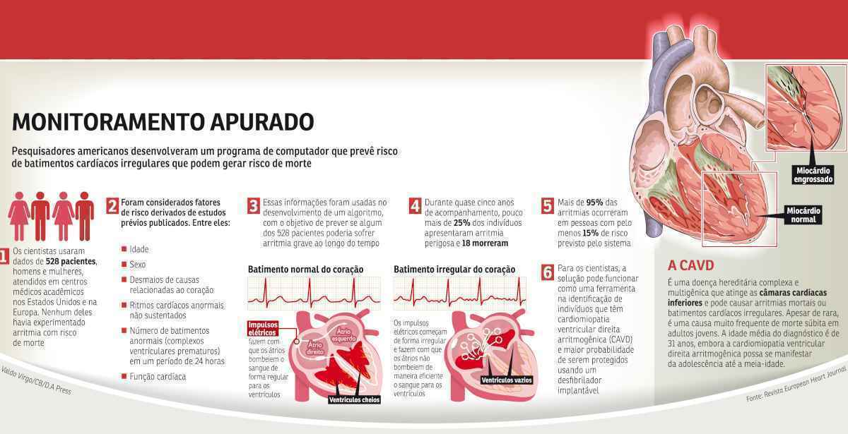 A cirurgia costuma ser feita em jovens e tem de ser repetida a cada 10 anos