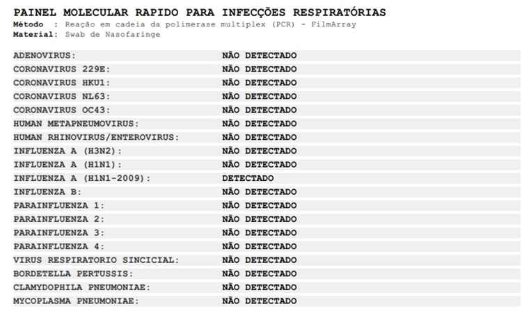 Exame indica presença de H1N1 em idosa que faleceu na última semana, no DF