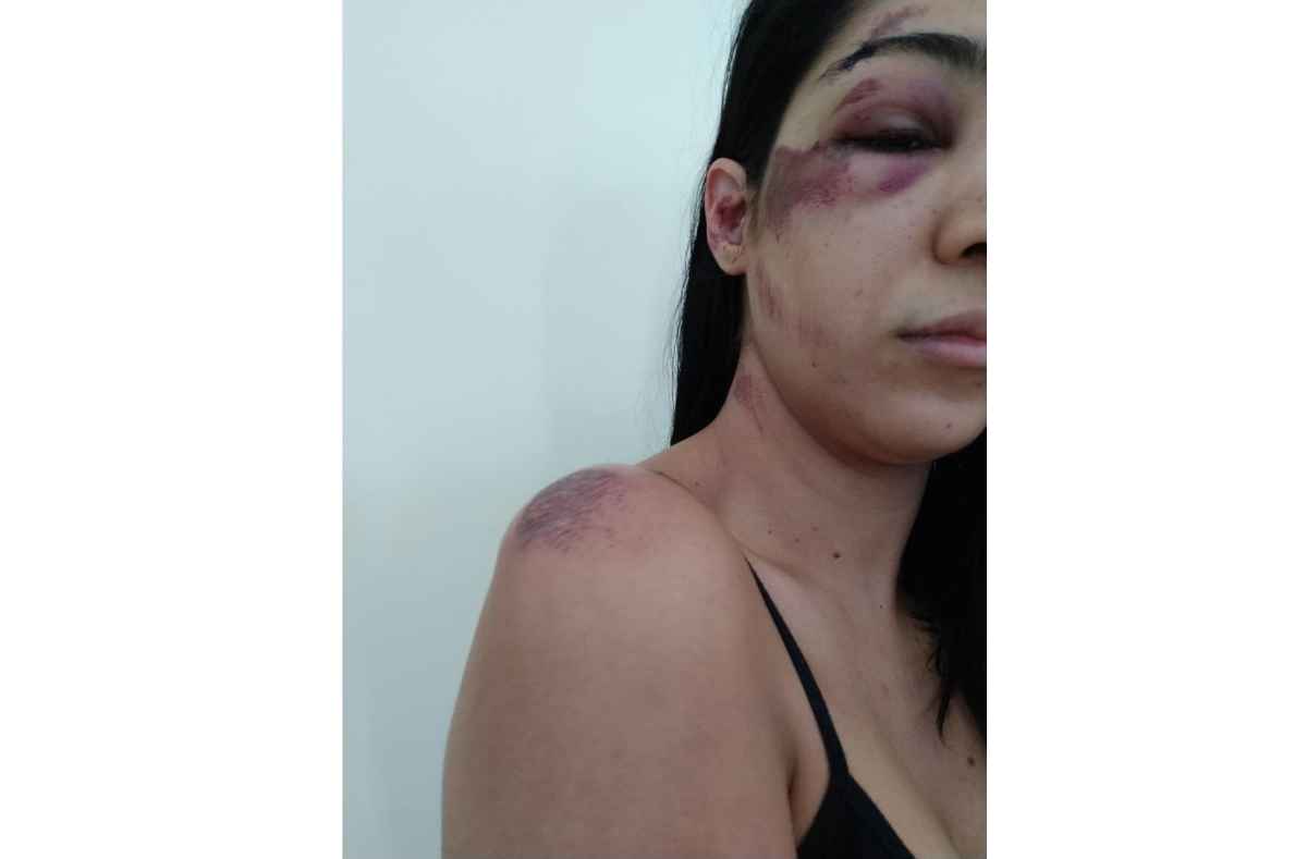 A agressão ocorreu na madrugada de sábado, segundo ocorrência registrada na Delegacia Especial de Atendimento a Mulher