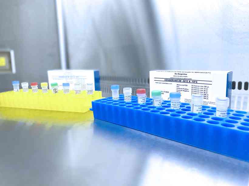 AlÃ©m das amostras que aguardam resultado, hÃ¡ ainda 392 testes cancelados e 1.969 nÃ£o realizados