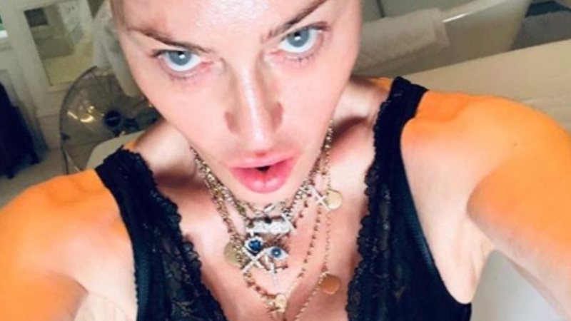 Madonna começará tratamento regenerativo do joelho e celebra com foto