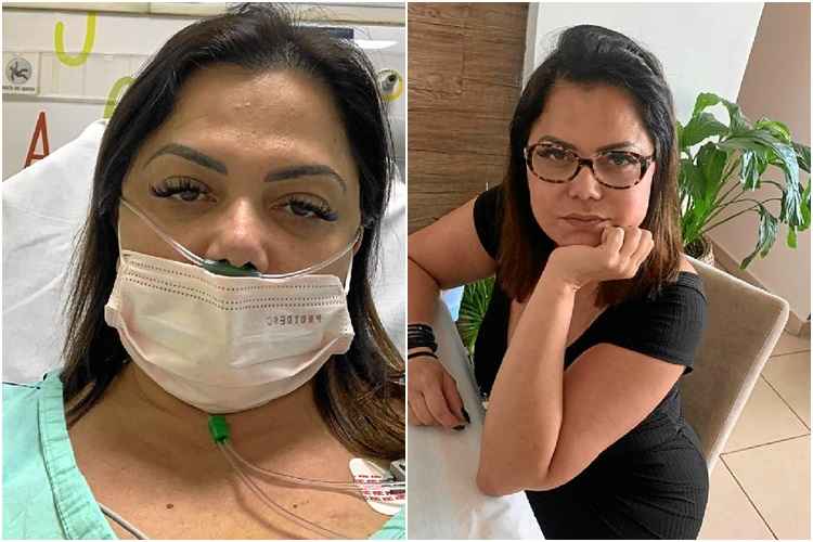 Antes e depois do novo coronavÃ­rus: a cantora Alessandra Leles recuperou-se da covid-19, mas estÃ¡ com a capacidade respiratÃ³ria comprometida